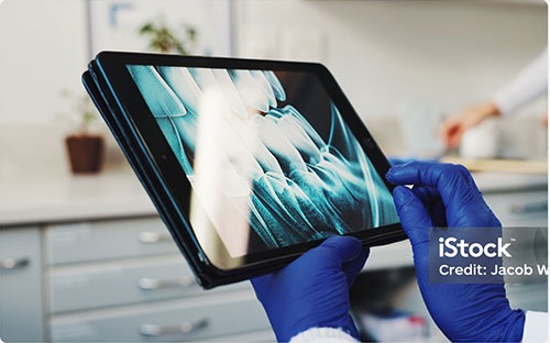 Digitales Röntgenbild in der Praxis